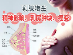 乳腺增生怎么引起的？该怎么办好？